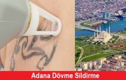 Adana Dövme Sildirme Fiyatları