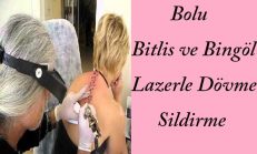 Bingöl Bitlis Bolu Dövme Sildirme Fiyatı