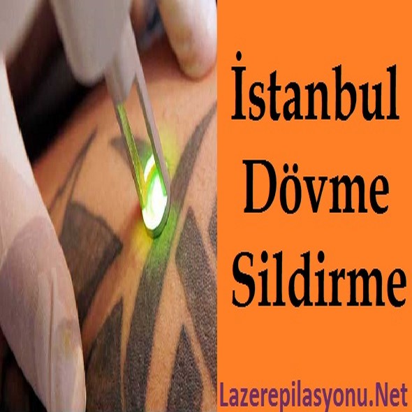 İstanbul Dövme Sildirme