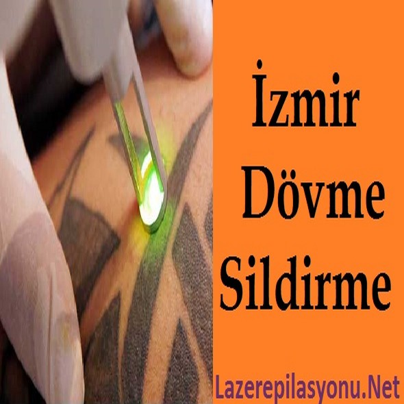 İzmir Dövme Sildirme