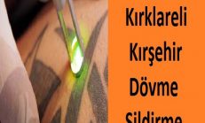 Kırıkkale Kırklareli Kırşehir dövme Sildirme