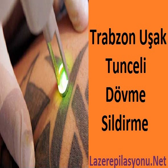 Trabzon Tunceli Uşak Dövme Sildirme