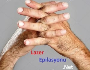 el ve parmak üstü lazer epilasyon.jpg